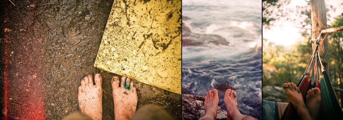 в первый день распорол себе ногу между пальцами, неделю заливался зеленкой